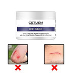 Pack of 2 Cetuem Ice Pack - 100ml each