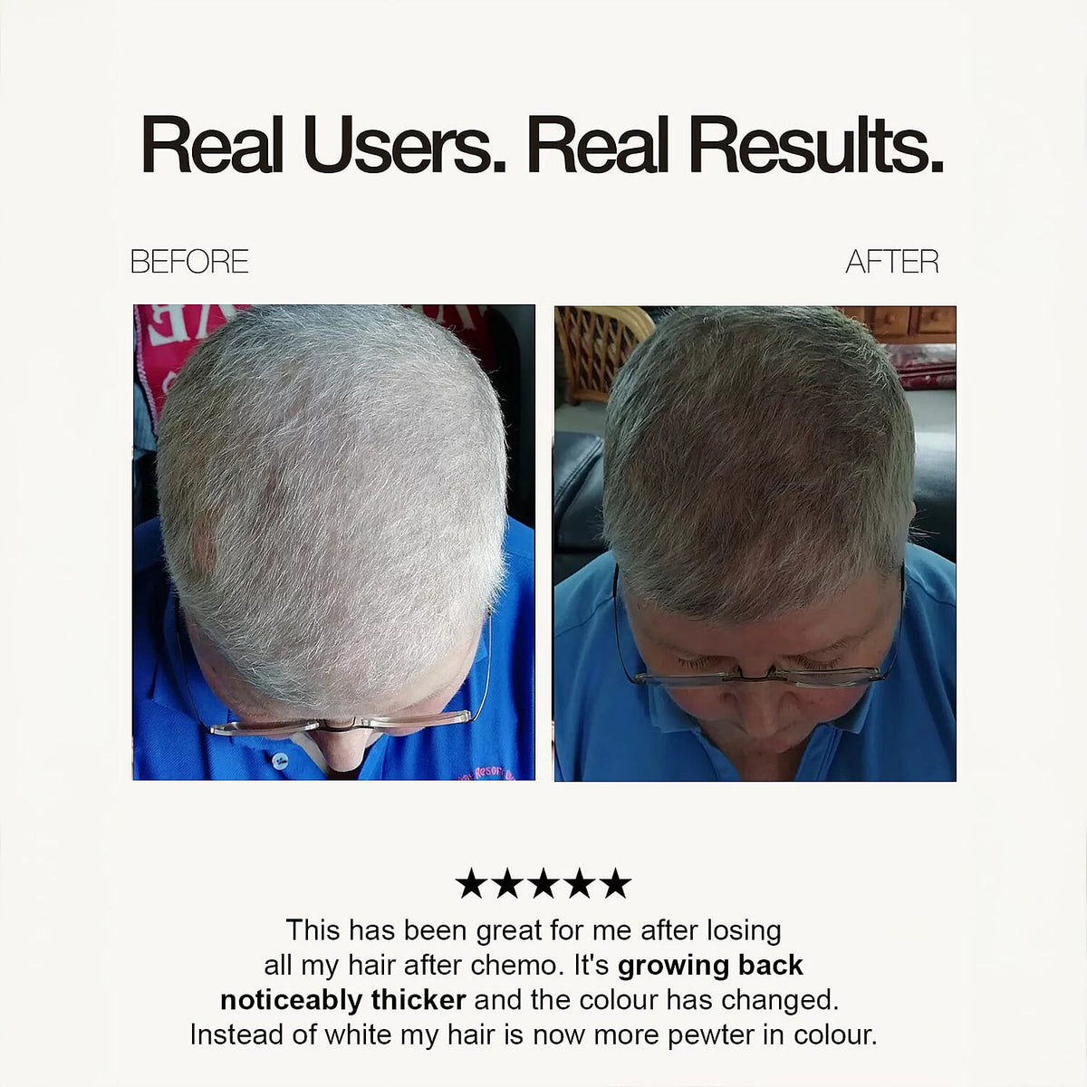 Opatra Lumicap Pro - Light Therapy for Hair Growth with Lifetime Warranty 7263115 6