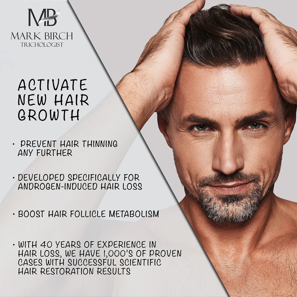 Mark Birch TR3 Double Strength Scalp Therapy Lotion - 50ml 8082696 5