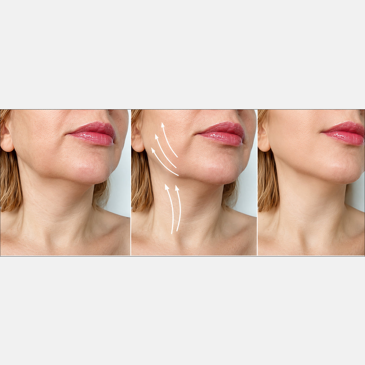 Last in Stock: Chin Fit Elite with Photon Face-Lifting Technology &amp; Infrared, RED &amp; BLUE Light for Double Chin &amp; Jawline 8421313 6