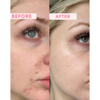 Sand & Sky Australian Pink Clay Resurfacing Mask - 80g_8665383_3