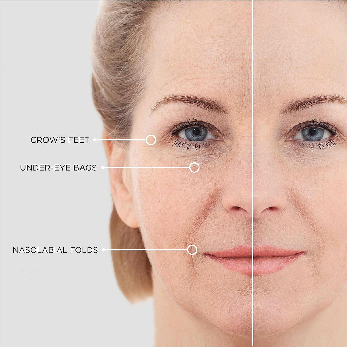 Beautical Microneedle Eye Patches 8127038 4
