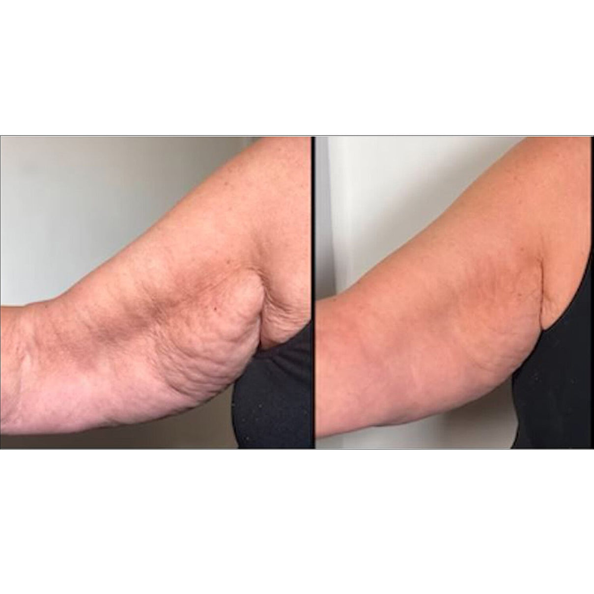 LAB LIFE + BEAUTY Titan Skincare Device 7768307 1