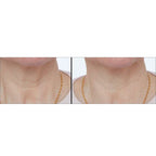 LAB LIFE - BEAUTY Body Device (Size 1x1 cm) - White