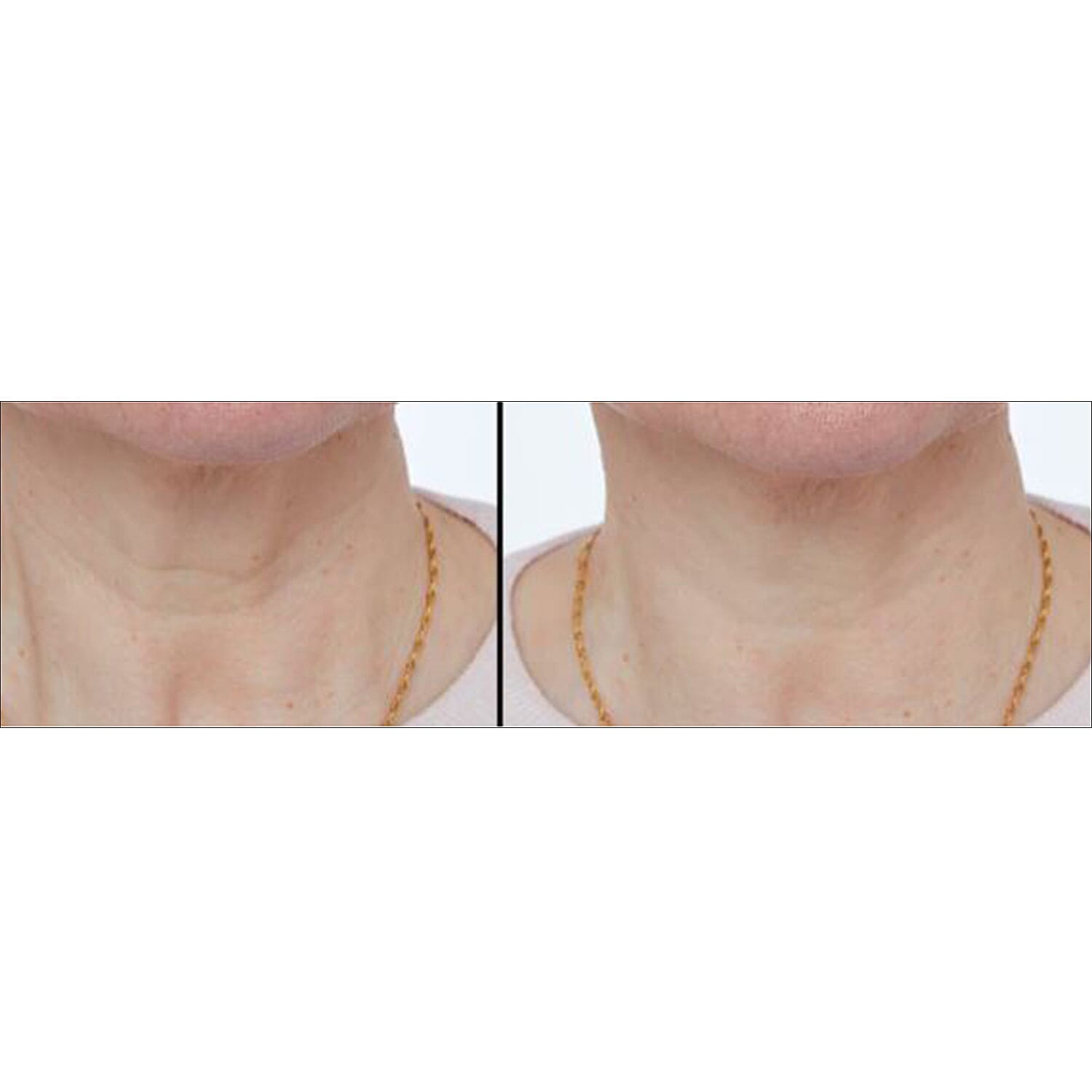 LAB LIFE + BEAUTY Titan Skincare Device 7768307 2