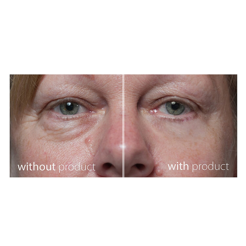 My Perfect Cosmetics- My Perfect Eyes - 20ml (With Free My Perfect Day Cream)