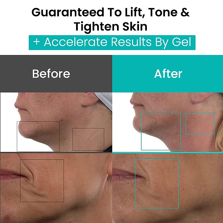 Nuovaluce Anti Aging Device with Conductive Gel 8960347 3