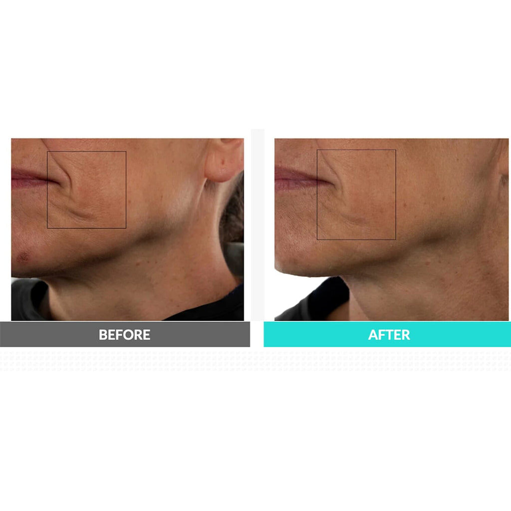 Nuovaluce Anti-Aging Device with Microcurrent and Red Light Therapy - Gel