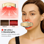 Opatra Cleo Lips Device - Lifetime Warranty
