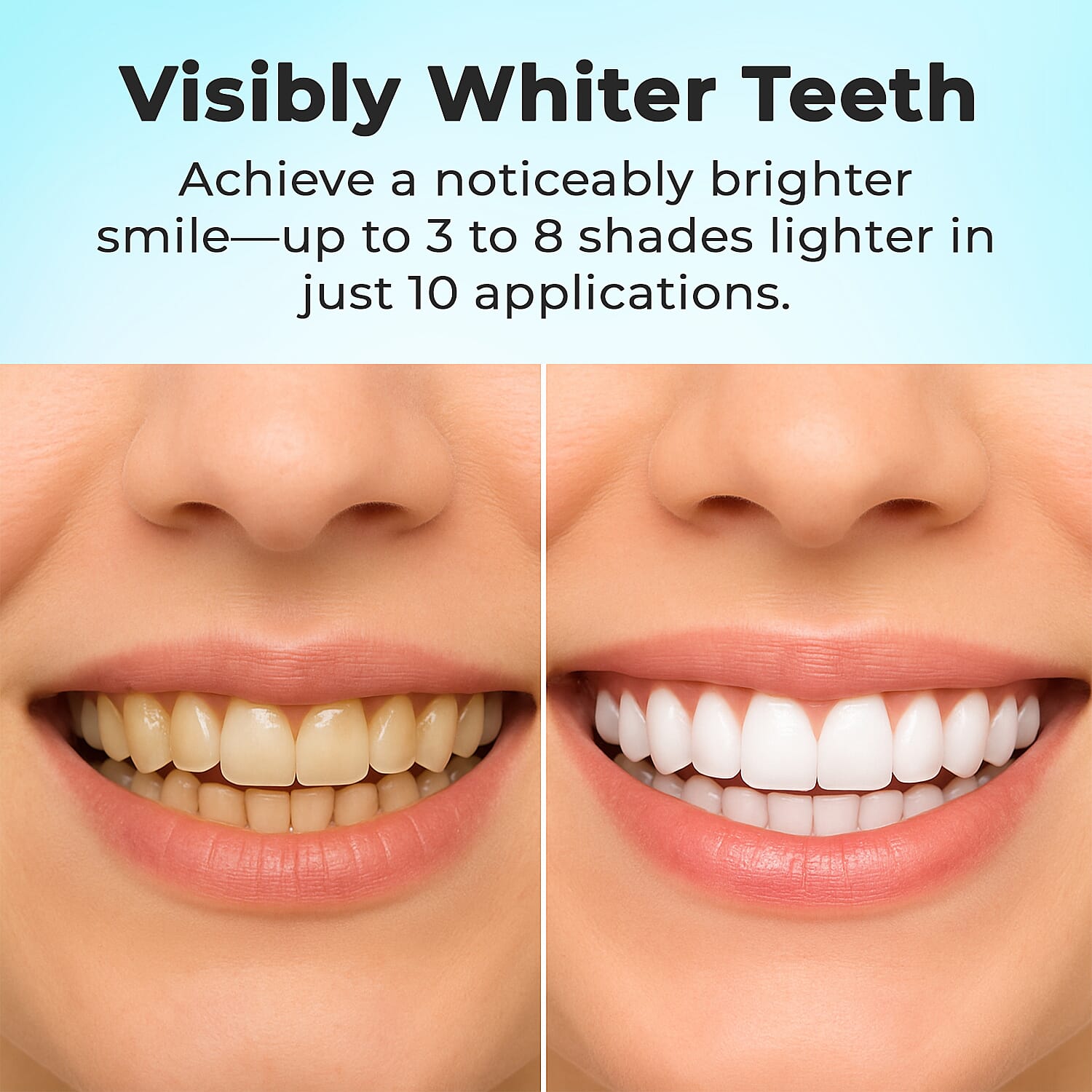 Opatra Smile - Teeth Whitening System 3643506 7