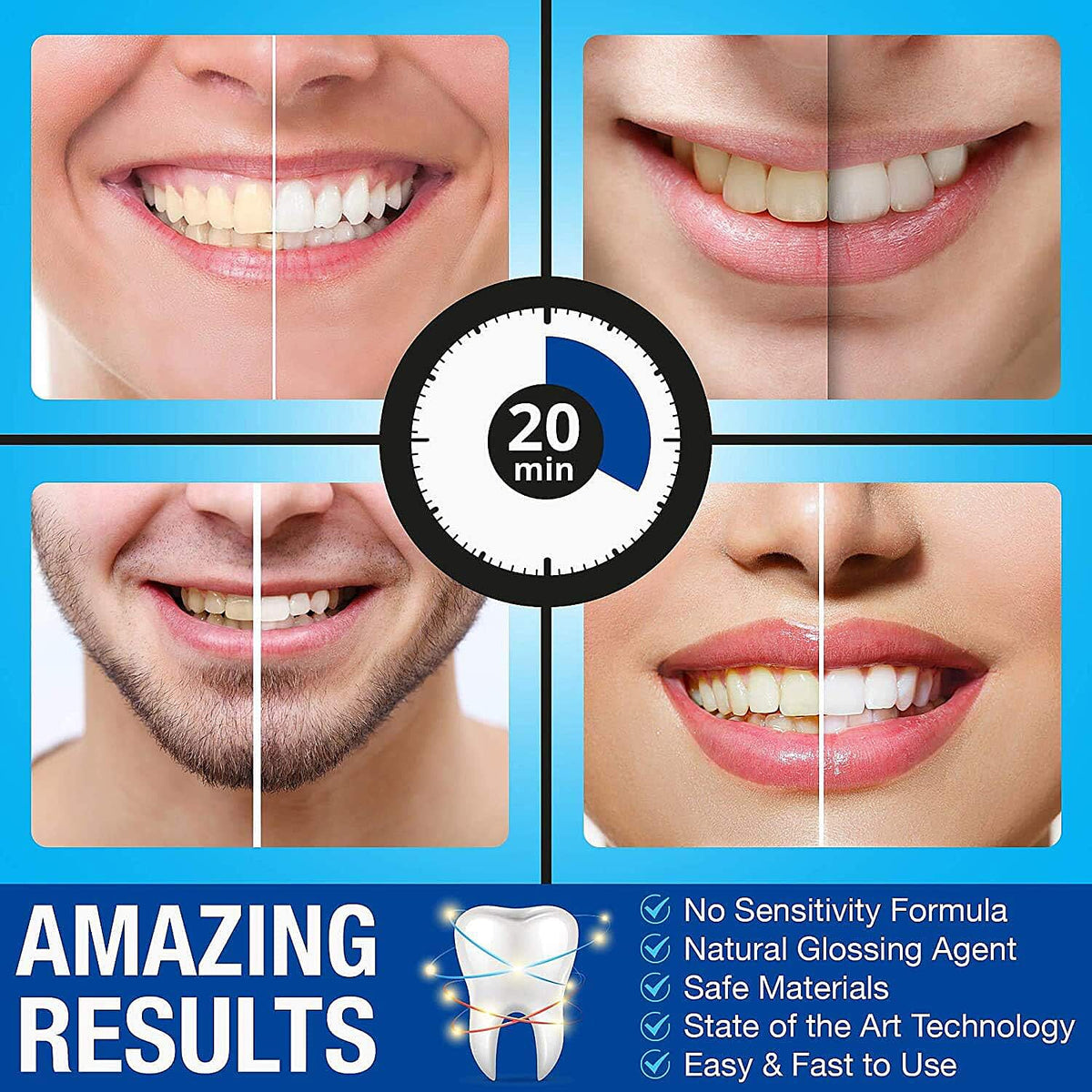 Pro Intellident Teeth Whitening Kit with LED Light 8021827 4