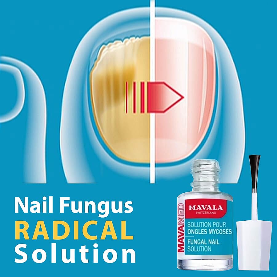 Mavala- Nail Fungal Treatment - 5ml 3171787 3