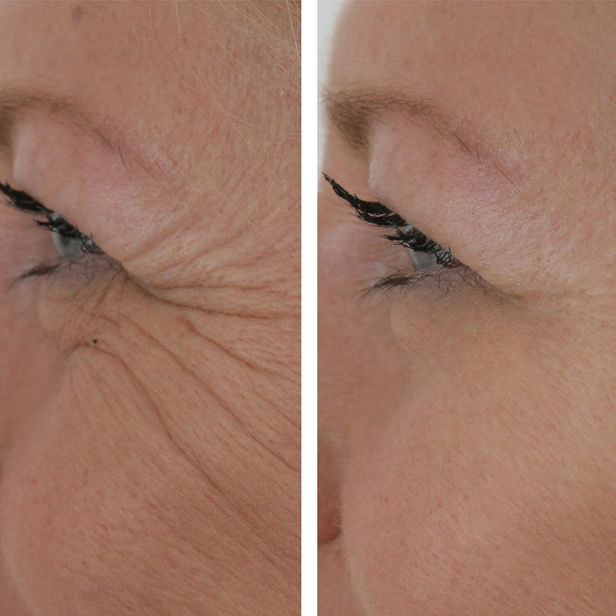 SKINEANCE Wrinkle Filler - Fills and Smoothes Fine Lines &amp; Wrinkles Immediately - 15ml 8149180 3