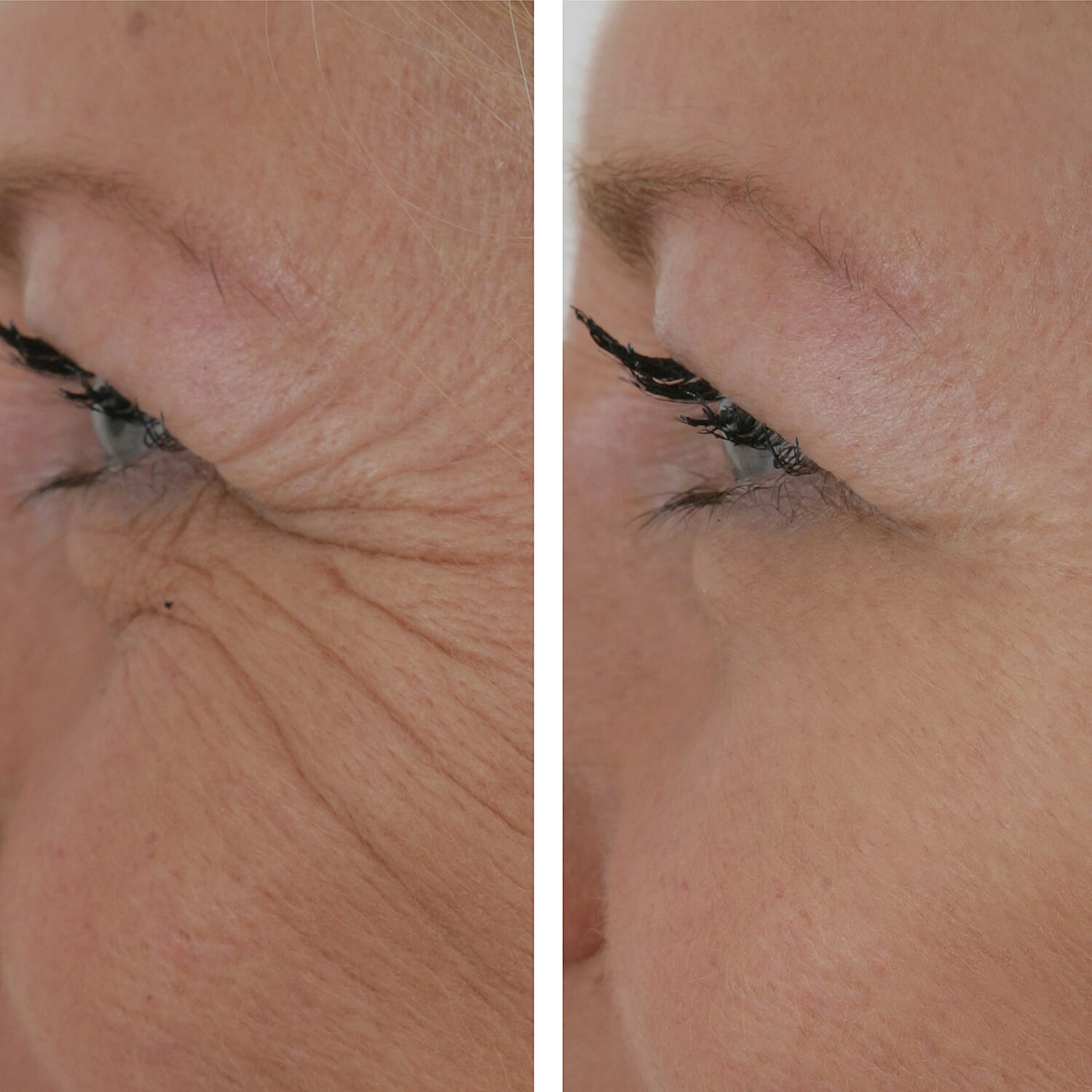 SKINEANCE Wrinkle Filler - Fills and Smoothes Fine Lines &amp; Wrinkles Immediately - 15ml 8149180 3